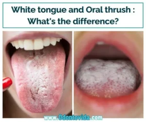how to clean your tongue